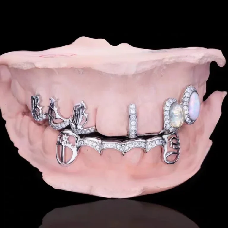 custom-moissanite-opal-grillz-front